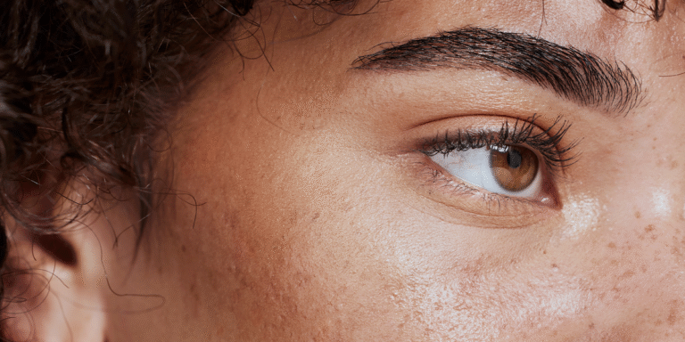Understanding pdrn skincare: a dermatologist explains the trend